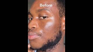 Anua Dark spot correcting serum for hyperpigmentation and dark spots [upl. by Dominik]