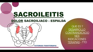 SACROILEITIS DOLOR SACRO ILIACO ENTENDIENDO LA DOLENCIA PATOLOGIA [upl. by Noll]