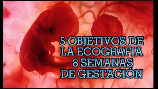 IMPORTANCIA DE LA ECOGRAFÍA 8 SEMANAS DE GESTACIÓN [upl. by Ringe]