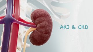 Acute kidney disease AKI and Chronic kidney disease CKD medications [upl. by Yelwah106]