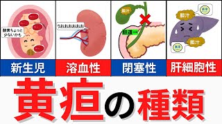 【15分で解説、30分で国試問題】黄疸について解説！肝胆膵の理解に必須です！ [upl. by Lubow423]