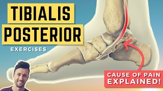 Tibialis Posterior Exercises Treat the Root Cause of Your Tib Post Pain PTTD [upl. by Avie341]