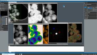 Multimodal Spectrum Imaging at Low kV with GIF Continuum K3 with Stela [upl. by Dwane193]