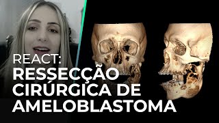 REACT RESSECÇÃO CIRÚRGICA DE AMELOBLASTOMA [upl. by Anahpos197]