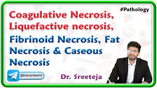 2 Coagulative necrosis Liquefactive necrosis Fibrinoid necrosis Fat necrosis amp Caseous necrosis [upl. by Burgwell127]