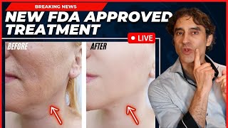 REMOVE JOWLS amp TIGHTEN YOUR FACE WITHOUT SURGERY Everything You Need To Know NEW Approved Procedure [upl. by Llyrehc418]