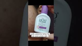 Lacto calamine face lotion review lacto calamine lotion for acne prone skin review shorts [upl. by Llerdnam139]