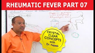 Rheumatic Fever amp Heart Disease Part 77 [upl. by Hazem367]