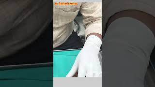 How Lignocaine Is Given Xylocaine कैसे दिया जाता है drsubhashkumar anaesthesia [upl. by Schaffer866]