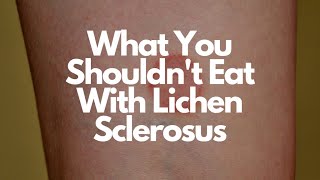 Foods to Avoid With Lichen Sclerosus amp Possible Treatments [upl. by Beaulieu187]