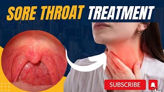 How to get rid of Sore throat  Sore throat remedies sore throat treatment  sore throat MHCP [upl. by Moclam]