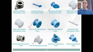 Otitis Media with Effusion OME Part2 [upl. by Nnhoj]