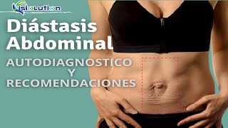 DIÁSTASIS ABDOMINAL  AUTODIAGNÓSTICO y RECOMENDACIONES  Fisiolution [upl. by Ttezzil947]