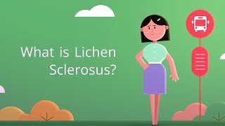 What is Lichen Sclerosus White Spot Disease [upl. by Essilrahc]