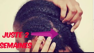 COMMENT FAIRE POUSSER SES CHEVEUX PLUS VITE JUSTE EN 2 SEMAINES [upl. by Sidwel]