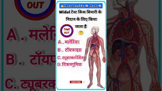 widal Test किस लिए किया जाता हैTyphoid testwidal test lab labtechnician shortvideo shorts [upl. by Aihtiekal]