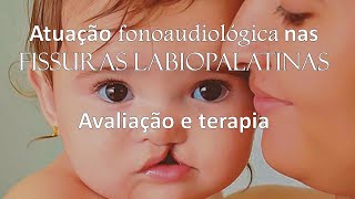 Atuação Fonoaudiológica nas Fissuras Labiopalatinas [upl. by Latouche386]