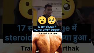 17 साल की age में steroids लेने से क्या हुआ  🥺😮  steroids side effects steroidssideeffects [upl. by Drofnats]