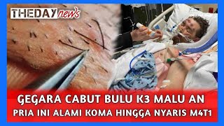 ALAMI KOMA GEGARA CABUT RAMBUT AREA KE MALU AN [upl. by Gazzo800]