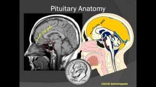 Amenorrhea and Galactorrhea [upl. by Matheny]