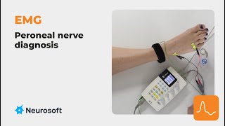 EMG the peroneal nerve diagnosis [upl. by Phare]