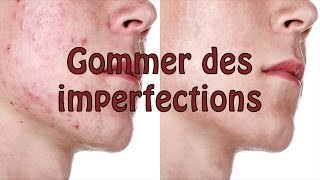 PHOTOSHOP Tutoriel  Gommer des imperfections acné etc dun visage [upl. by Franchot]