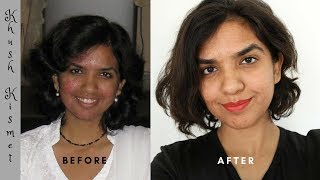 How did I cure cystic acne and rosacea [upl. by Edbert314]