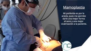 Mamoplastia  Dr Nelson Chaves [upl. by Fisk691]