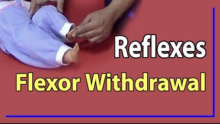 01 Flexor Withdrawal Reflex [upl. by Karee459]