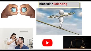 Mastering in Binocular Balancing by Alternate occlusion test [upl. by Annayat809]